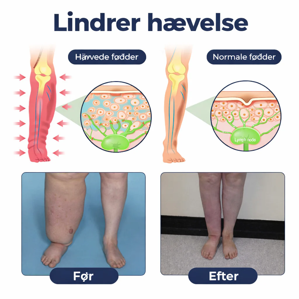 BenRo™ – Lindrende bencreme til lette ben og bedre blodcirkulation - Image 2