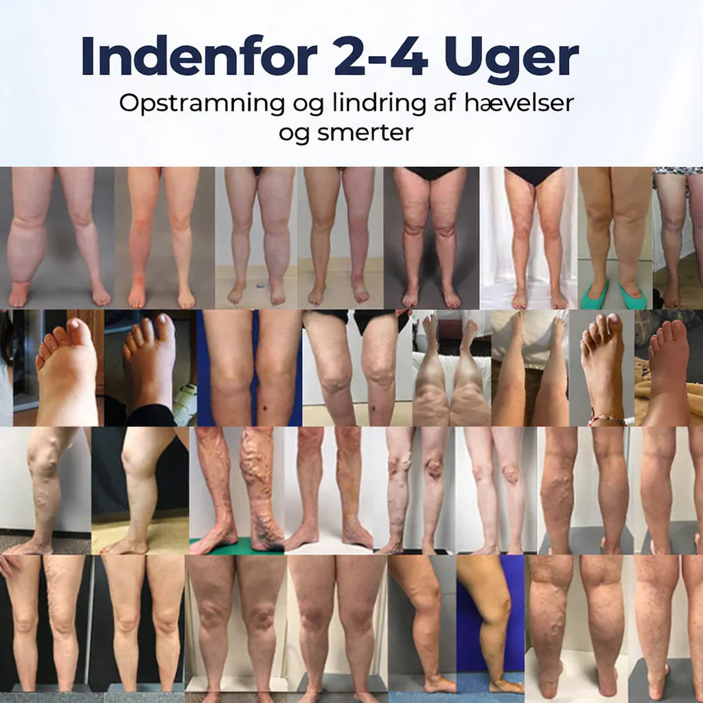 BenRo™ – Lindrende bencreme til lette ben og bedre blodcirkulation - Image 4