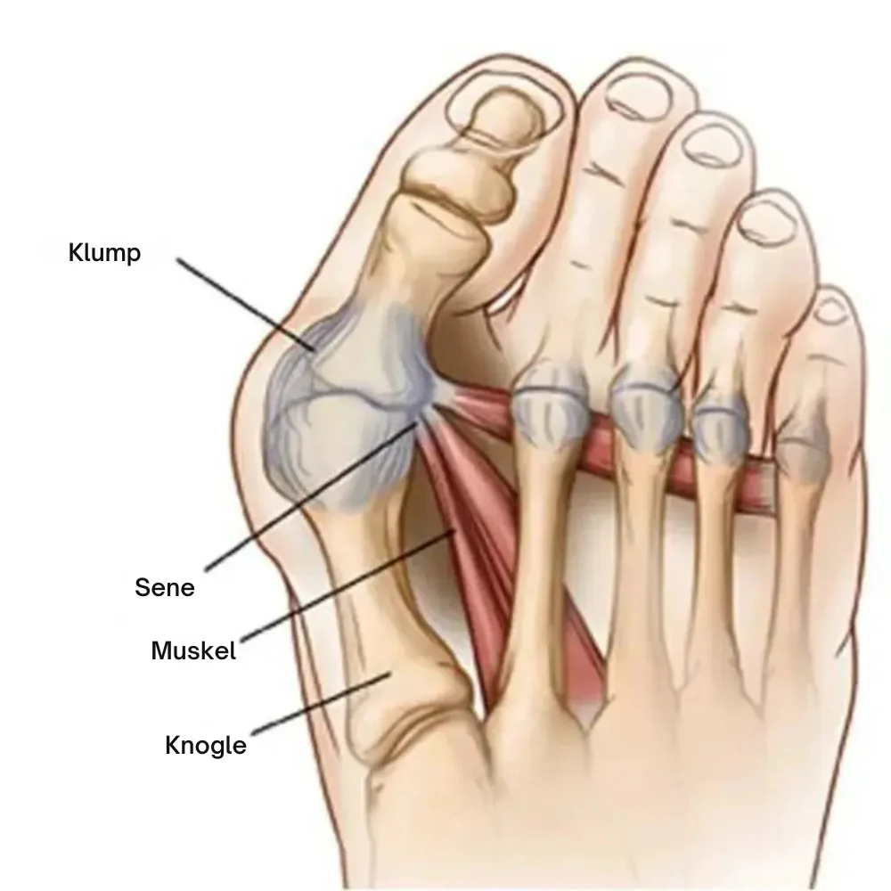 FodKorrekt™ | Genskab din fods naturlige balance – helt uden indgreb - Image 7