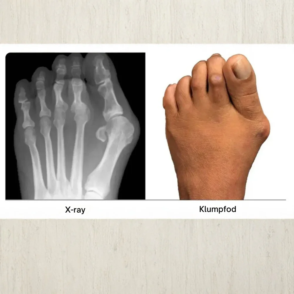 FodKorrekt™ | Genskab din fods naturlige balance – helt uden indgreb - Image 9