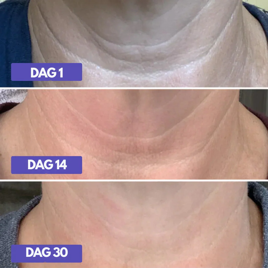 HalsLøft™ – Opstrammende Hals- & Dekolletagecreme - Image 6