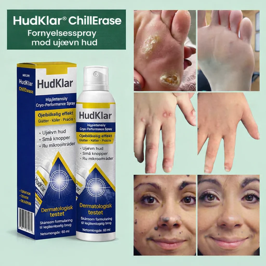 HudKlar™ ChillErase – Præcis kølende spray til glattere hud - Image 4