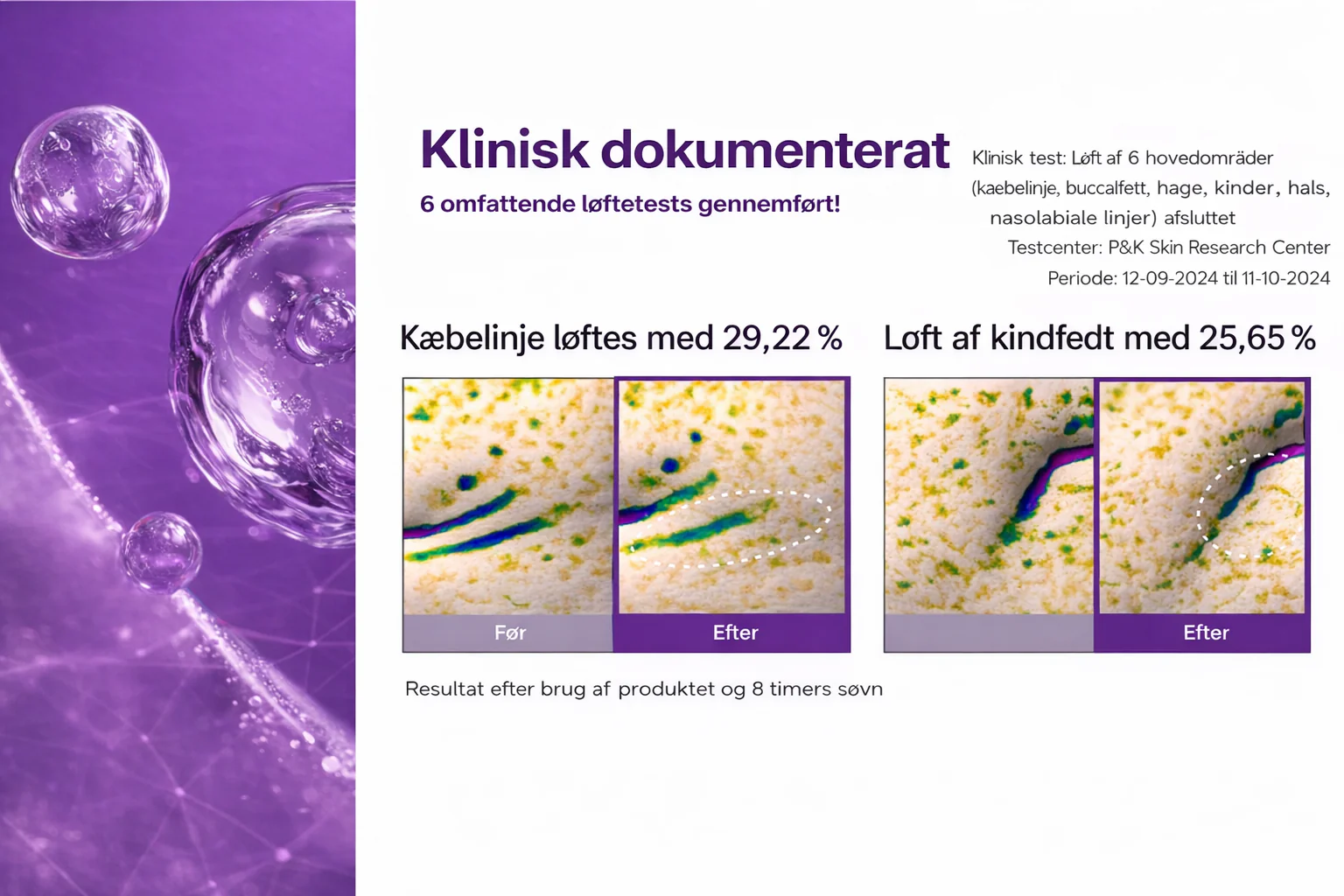 HudKlar™ – NAD+ Løfteserum & Maske - Image 11