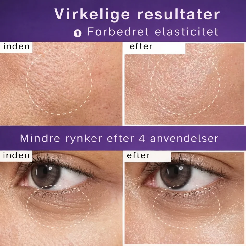 HudKlar™ – NAD+ Løfteserum & Maske - Image 14