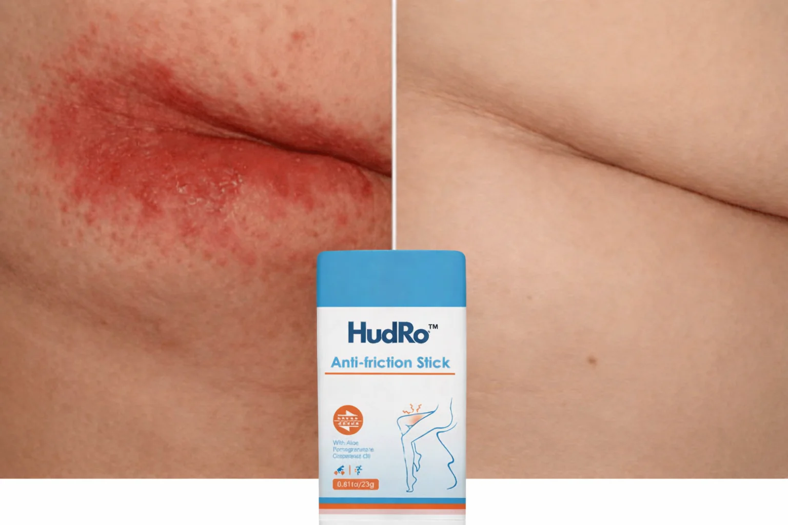 HudRo™ – Anti-friktions stick til irriteret hud - Image 4