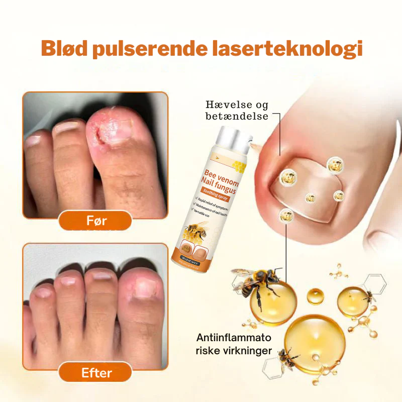 KlarNegl™ – Avanceret Svampedræbende Negleplejespray - Image 3