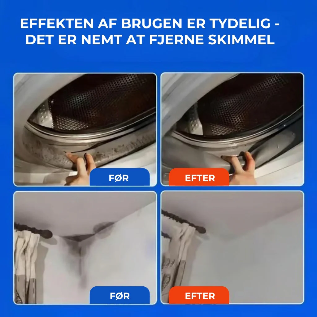 SkimmelStop™ - Hurtigvirkende spray mod skimmel - Image 6
