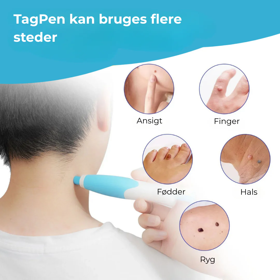 SkinEase™ Pen – Sikker fjernelse af hudmærker! - Image 5