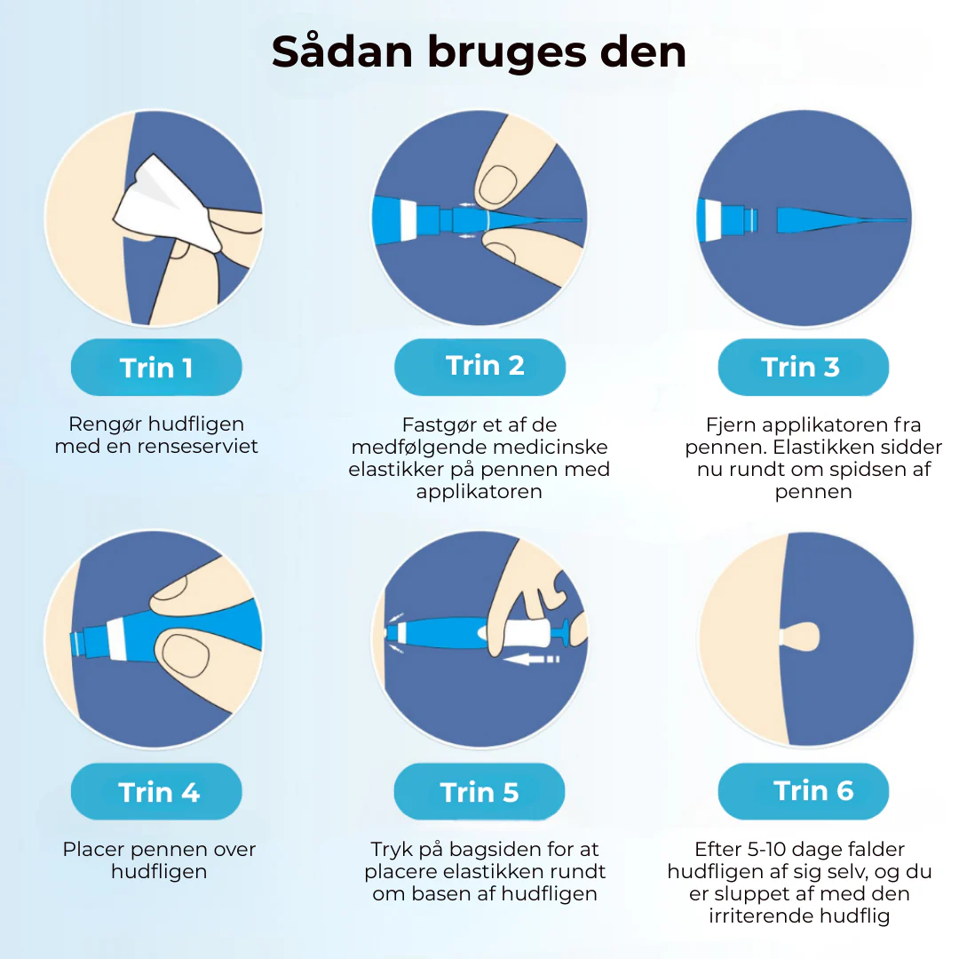 SkinEase™ Pen – Sikker fjernelse af hudmærker! - Image 7