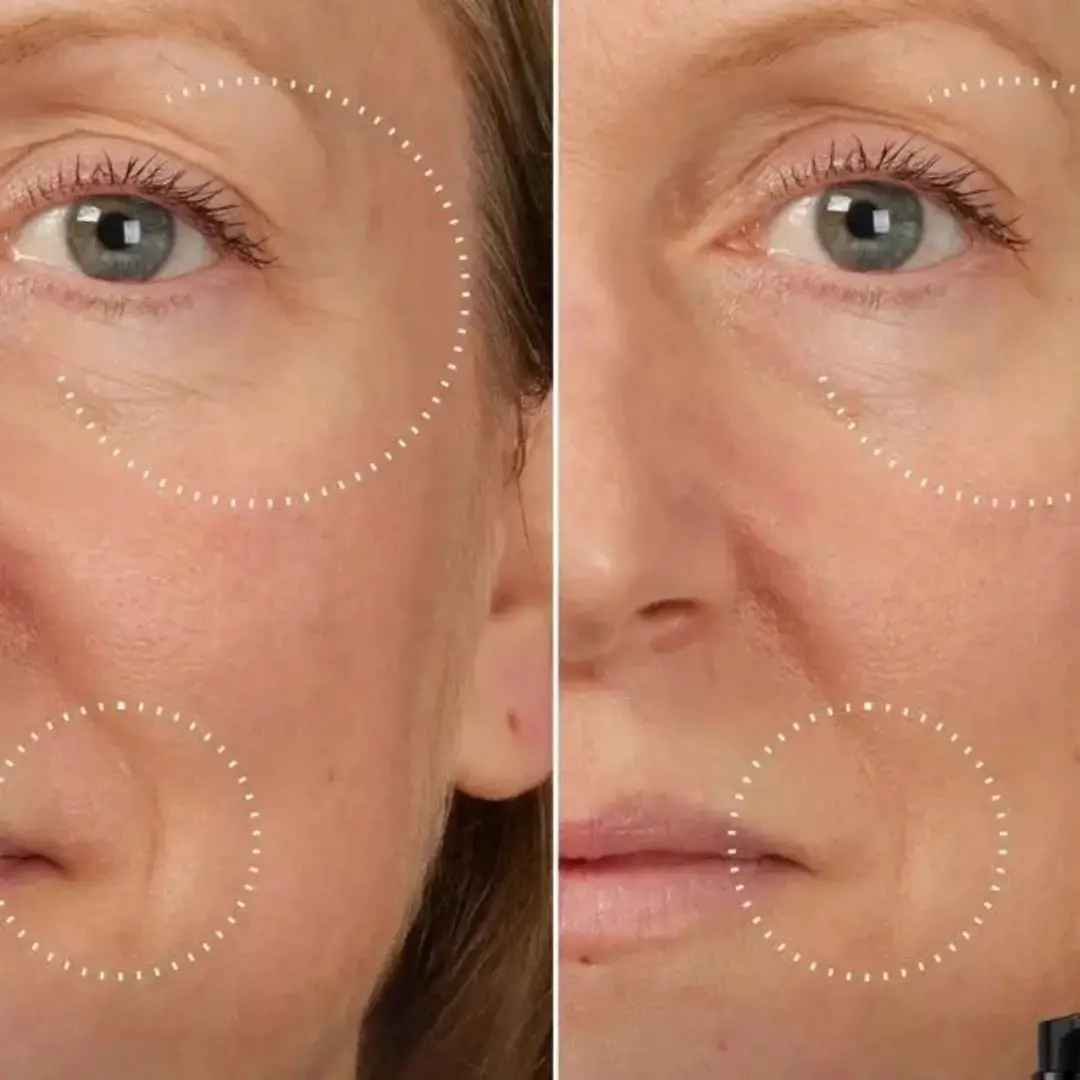 SkinLift™ Botox Serum - Synligt yngre hud på 14 dage. - Image 5