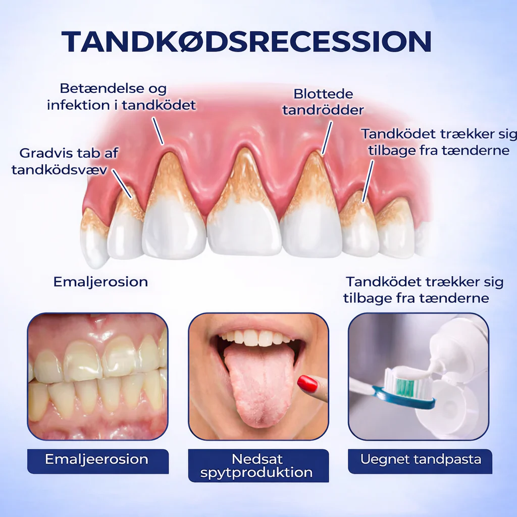 TandKraft™ – Tand- & Tandkødsstyrke - Image 7