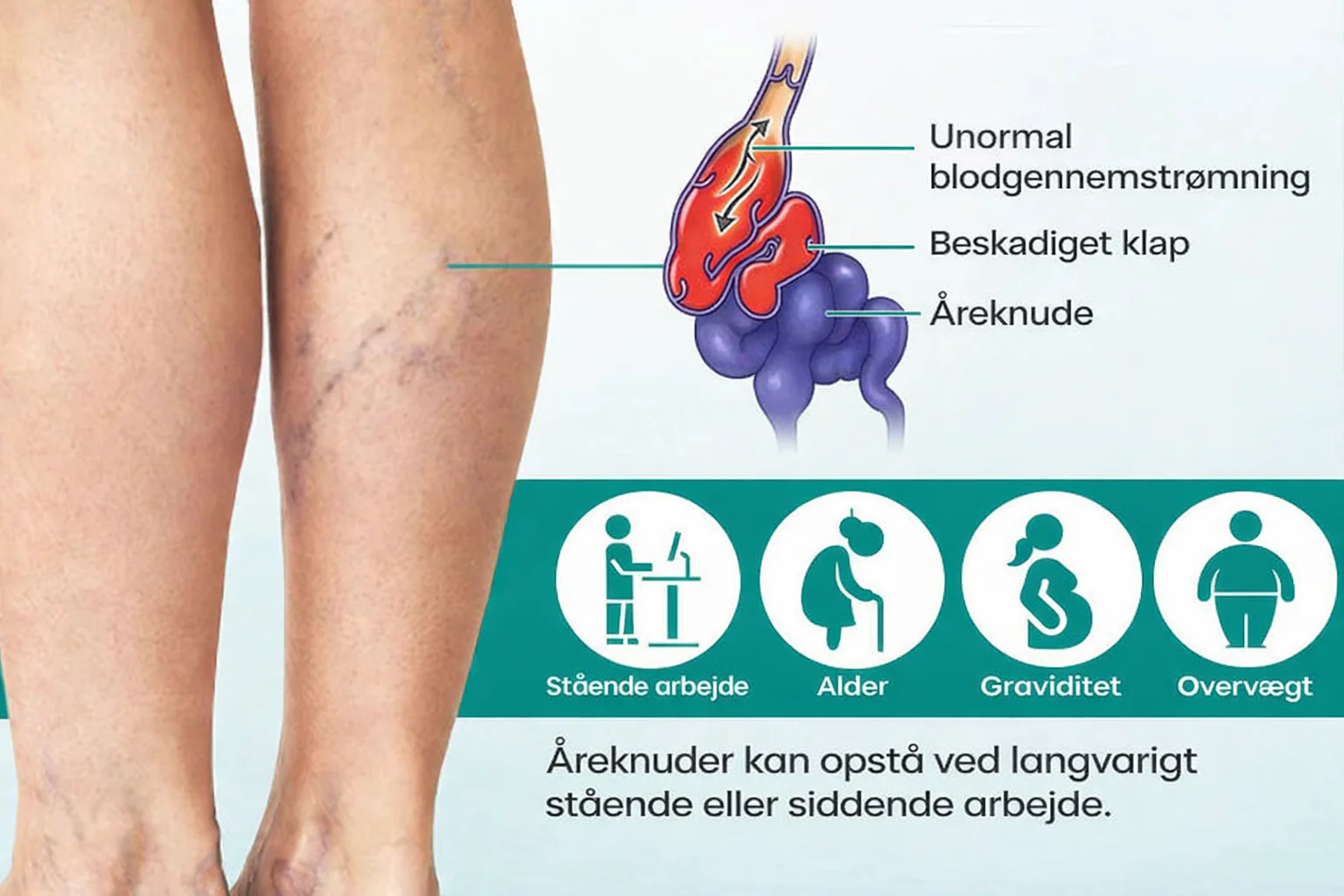 VenaLindre™ – Micronåle-patch til støtte for vener og lindring af tunge ben - Image 9
